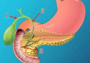 胆结石手术后多久恢复