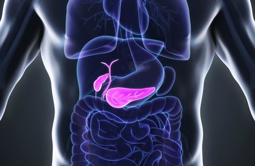 胆结石的形成因素及预防方法,千万警惕体内 疯狂的石头