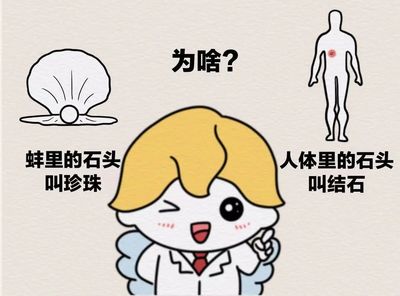 珍珠、舍利子、巧克力豆?打扰了,其实都是"胆结石"
