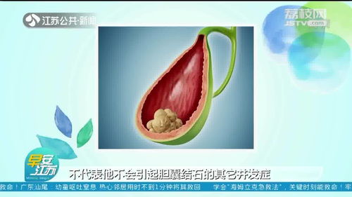 无症状的胆结石需要治疗吗 来听听专家怎么说