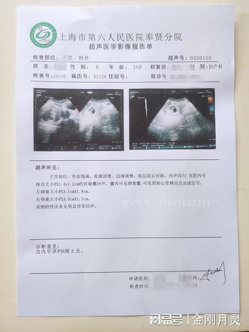 辽宁省沈阳医院泌尿生殖系统病症病历肾结石胆结石手术病历单图片