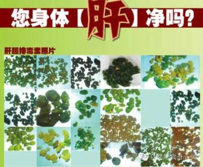 进行肝胆排毒很重要