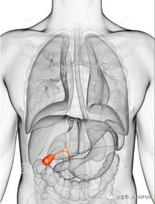 胆结石会引发什么严重后果