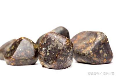 胆结石多大才需要手术?无疼痛是否可以药物排石?听专家怎么说