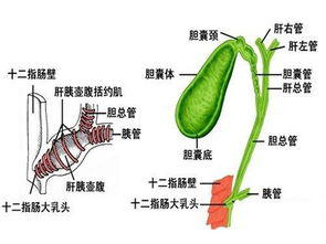 怎样才能治疗胆结石
