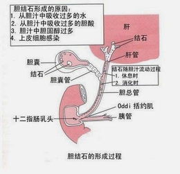 天津市南开医院治疗胆结石医生
