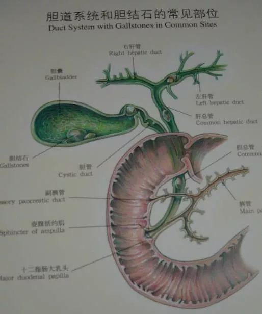 微创保胆取石技术 胆结石患者的首选
