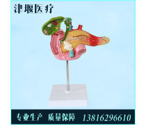 消化系统健康之路 解读胆结石模型产品及其作用