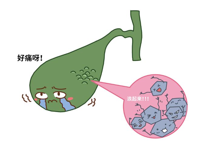 有胆结石可以买百万医疗险吗？最宽松的产品都在这！
