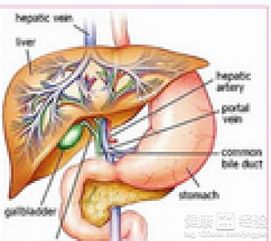 孕妇胆结石吃什么好