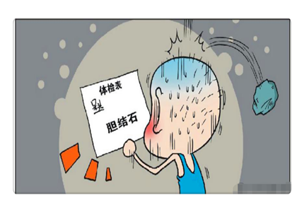 胆结石卡通图 生动了解胆结石的外观与成因